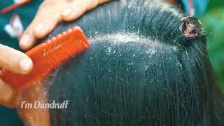 How to remove dandruff from hair at home #575