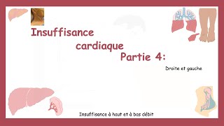 Insuffisance Cardiaque Partie 4:Insuffisance Droite Et Gauche