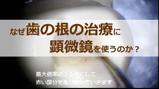 なぜ歯の根の治療に顕微鏡を使うのか？ | 大手町デンタルクリニック