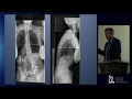 A Multidisciplinary Approach to the Management of Spinal Disorders - Sigurd Berven, M.D.