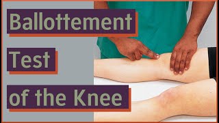 Ballottement Test Knee Joint Effusion