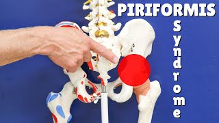 Piriformis Test & Simple Treatment That Works; Everything You Need to Know!