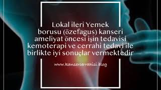 Lokal ileri Yemek borusu (özefagus) kanseri ameliyat öncesi işin tedavisi kemoterapi ve cerrahi ted…