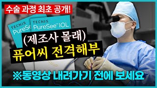 퓨어씨 완.전.정.복 (수술은 이렇게 합니다) 제조사 몰래 퓨어씨 전격 해부 #퓨어씨 #퓨어씨렌즈