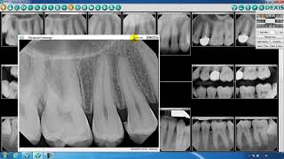 DEXIS™ Imaging Suite Image and Navigator Overview