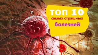 топ 10 самых страшных болезней человечества | Страшная история | неболей | здоровье