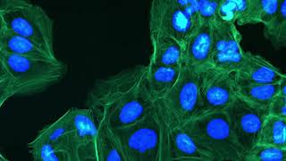 Optolong Fluorescence Filter Set Comparation FITC/DAPI/TexRed