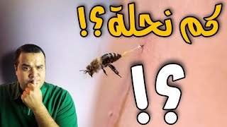 العلاج ب(سم النحل) || آخذ (كم نحلة) في كل جلسه؟؟🤔🤔