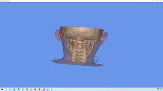 VTK Example - FixedPointVolumeRayCastMapperCT - Cxx