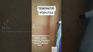 TEYS \u0026 Tendinitis Poplitea