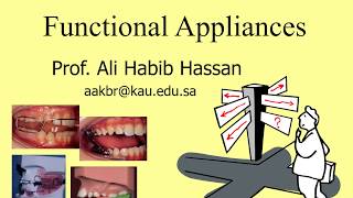 Functional Appliances for the Treatment of Class II malocclusion