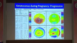 AIOC2022 IC195 Topic Dr  ASHOK SHARMA WHEN… AND WHEN NOT TO CROSS LINK