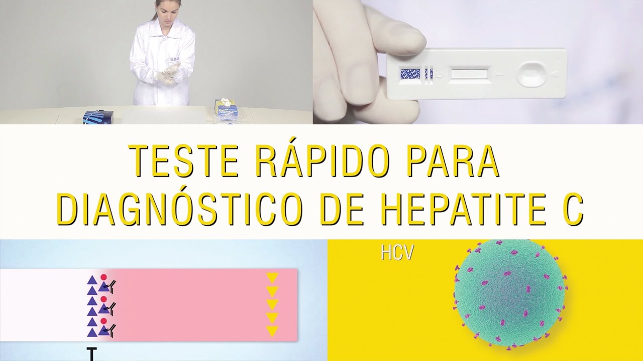 Teste Rápidos Para Diagnóstico Da Hepatite C - YouTube