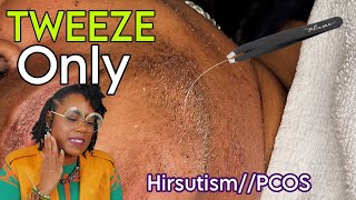 Tweezing Chin Hairs // PCOS // Facial Hair Removal *Tweeze Video*