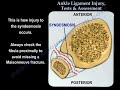 ankle ligament injury evaluation and tests everything you need to know dr. nabil ebraheim