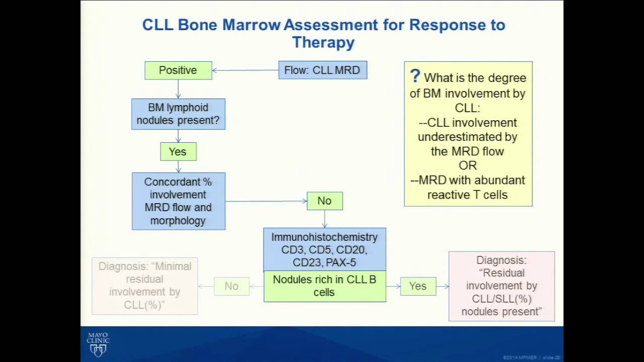 B Cell Chronic Lymphocytic Leukemia: Strategies For Diagnosis ...