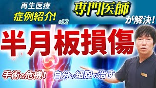 半月板損傷を放置し、手術の危機に！それを救った再生医療・バレーボールが趣味の50代女性の場合 【専門医師が解説】