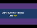 Ultrasound Case 004