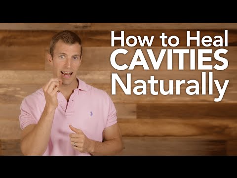 How to Treat Cavities Naturally How to Treat Cavities Naturally