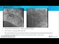 Gergis_Something to care about in left main PCI_Coronary