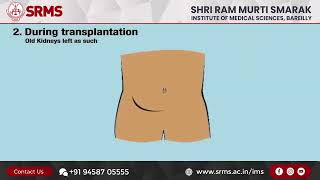 SRMS Institute of Medical Sciences  Department of Kidney Transplant..