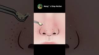 ASMR animation | Immersive nose blackhead removal animation