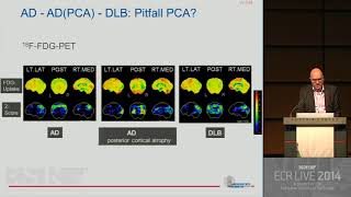 Neuro RC 1611   Neuroimaging in dementia 4