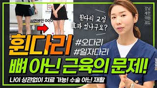 #휜다리 #오다리 교정하면 좋아질 수 있습니다! 건강하고 예쁜다리 만드는 법!