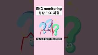 이게 정상 EKG wave가 맞나?