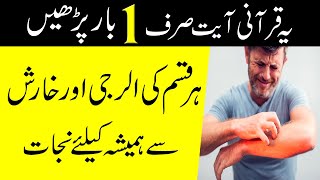 Best wazifa for itchy skin treatment - kharish ka ilaj in urdu (how to stop skin itching)