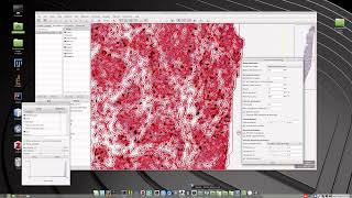 Breast Cancer KI67 assessment using with the open source QuPath