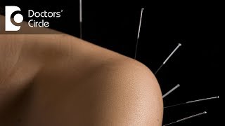 Which conditions can be treated with Acupuncture? - Dr. Arun Kumar K G