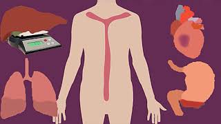 Post-Mortem Animation