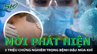 Mới Phát Hiện Thêm 3 Triệu Chứng Nghiêm Trọng Của Bệnh Đậu Mùa Khỉ Rất Dễ Chẩn Đoán Nhầm I SKĐS