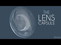 Yag Laser Capsulotomy for PCO After Cataract Surgery