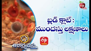 Early signs of a Blood Clot | నొప్పులను నివారించే ఆహారాలు |Aarogyamastu | 25th March 2021