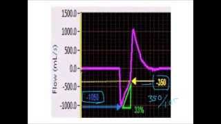 APRV: Setting T-Low based on the expiratory flow waveform