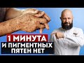 Благодаря ЭТОМУ – ваша кожа будет МОЛОДОЙ! / Как избавиться от пигментных пятен?