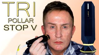 TriPollar Stop V Before \u0026 After | Radiofrequency \u0026 DMA Skin Tightening