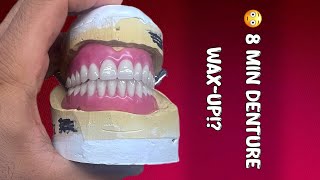 🔥 Fast Full Denture Wax-Up