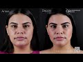 CiR Harmonização Facial - #2