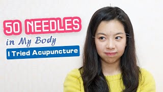 I Tried Acupuncture for the First Time!