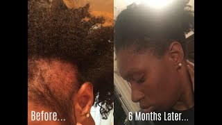 How To Grow Your Edges Back?? Does WILD GROWTH HAIR OIL really work?