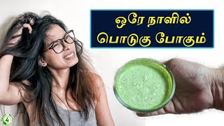 ஒரேநாளில் பொடுகு  அடியோடு நீங்க இது ஒன்று போதும் .... Podugu poga,   dandruff home remedy