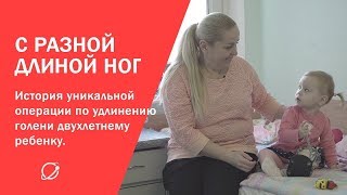 С разной длиной ног: история уникальной операции по удлинению голени двухлетнему ребенку