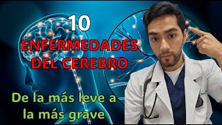 10 ENFERMEDADES QUE PUEDEN AFECTAR TU CEREBRO!!! De la más leve a la más grave. Todo Claro