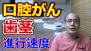 歯茎にできる口腔がんの進行速度はどのくらいか？【千葉市中央区の歯医者】