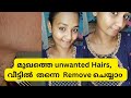 Easy home remedy for removing unwanted hairs on face😍|CHANTHUZZ ASWOO|