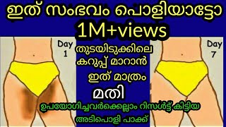 ഇത് സംഭവം പൊളിയാട്ടോ 😱😱😍😍 തുടയിടുക്കിലെ കറുപ്പ് മാറ്റാൻ ഇത് മാത്രം മതി