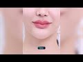 ปากสวย มั่นใจ filler lip sexy kiss💋 ปากฉ่ำขนาดนี้ ต้องที่ luxury clinic นะคะ